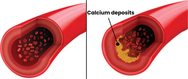 Artery illustration