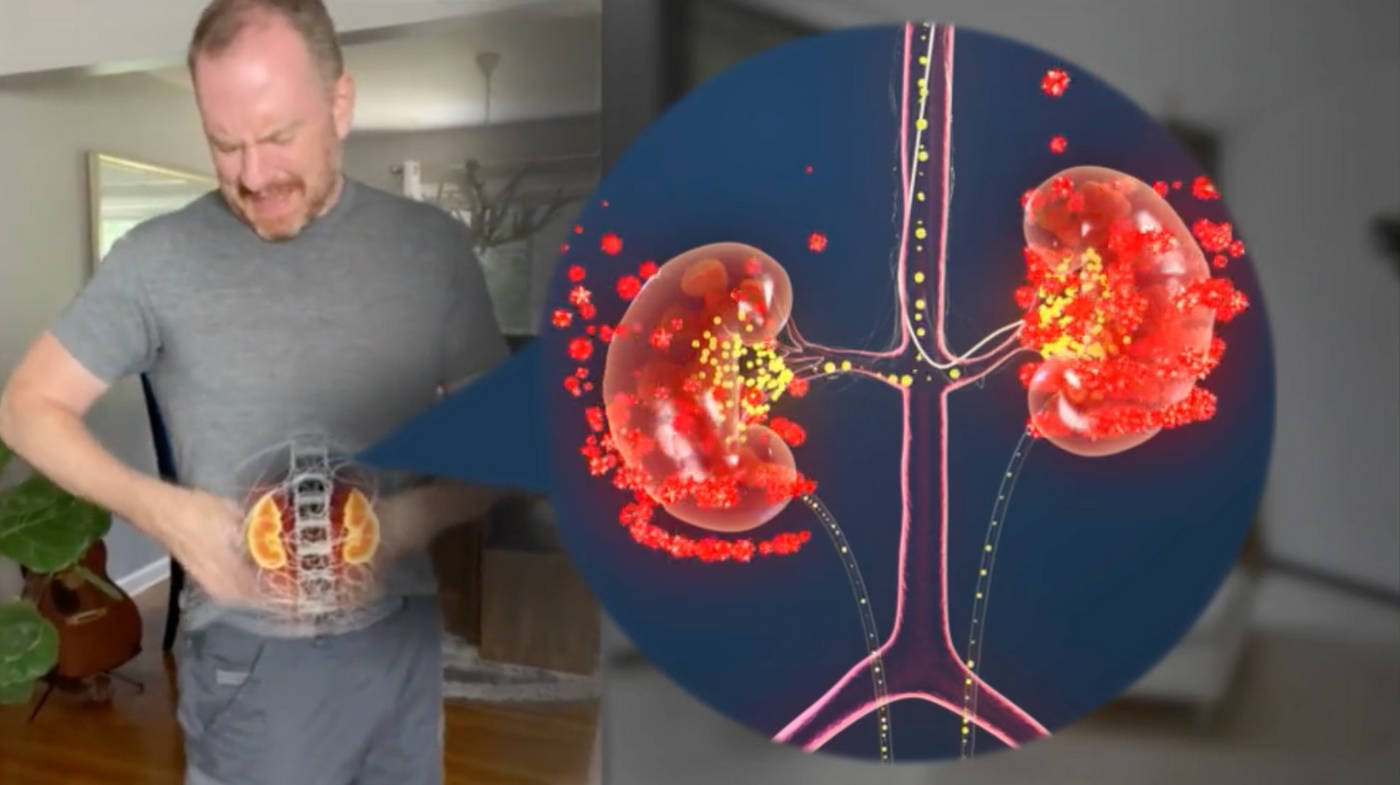 Shocking Truth: The Real Root Cause of Kidney Damage